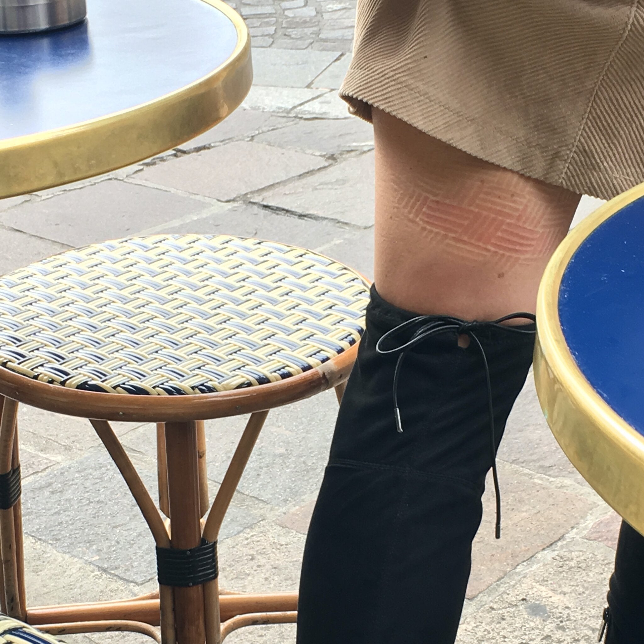 Seat Square | Woman showing waffle thighs, or a weave pattern on the back of her leg from sitting on a bistro chair in Paris without a Seat Square